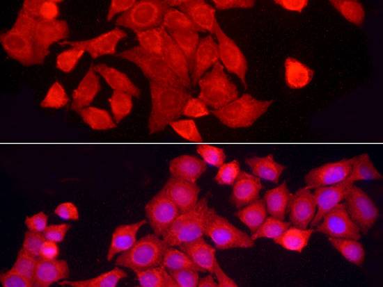 PTPN2 Polyclonal Antibody