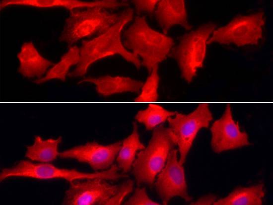 PTPN2 Polyclonal Antibody