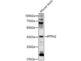PTPN2 Polyclonal Antibody
