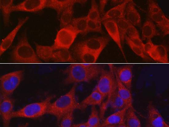NG2/CSPG4 Polyclonal Antibody