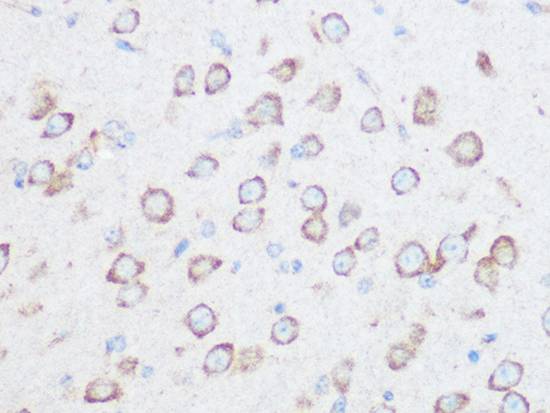 NG2/CSPG4 Polyclonal Antibody