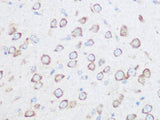 NG2/CSPG4 Polyclonal Antibody