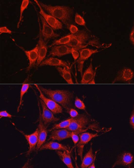 Glutamine Synthetase Polyclonal Antibody