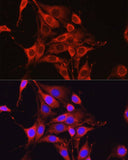 Glutamine Synthetase Polyclonal Antibody