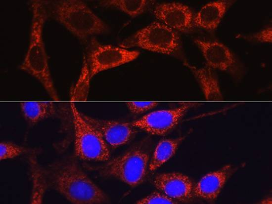 Glutamine Synthetase Polyclonal Antibody