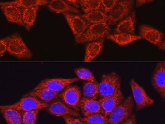Glutamine Synthetase Polyclonal Antibody