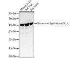 Glutamine Synthetase Polyclonal Antibody