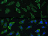 ECE1 Polyclonal Antibody