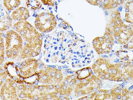 ECE1 Polyclonal Antibody