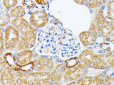 ECE1 Polyclonal Antibody