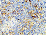 ECE1 Polyclonal Antibody