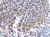 FUS Polyclonal Antibody