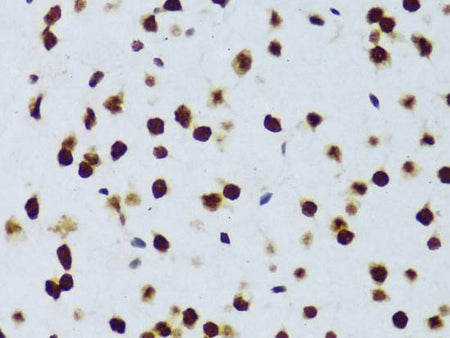 FUS Polyclonal Antibody