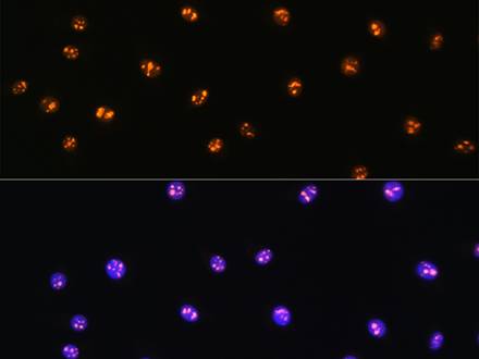 MST1/MST1/MST1/MST1/STK4 Polyclonal Antibody