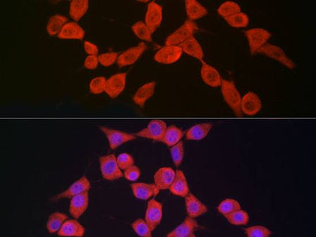 NLRP3 Polyclonal Antibody