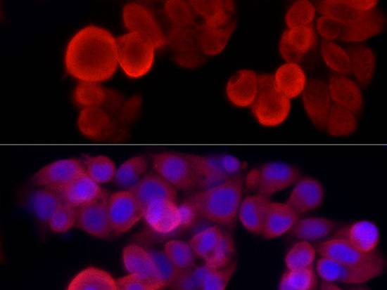 NLRP3 Polyclonal Antibody