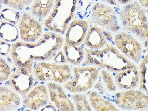 NADPH Oxidase 4 (NOX4) Polyclonal Antibody