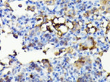 NADPH Oxidase 4 (NOX4) Polyclonal Antibody