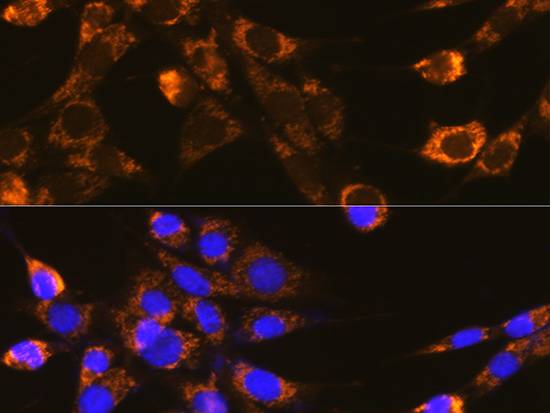 Integrin-β1/CD29 Polyclonal Antibody