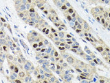 Ki67 Polyclonal Antibody