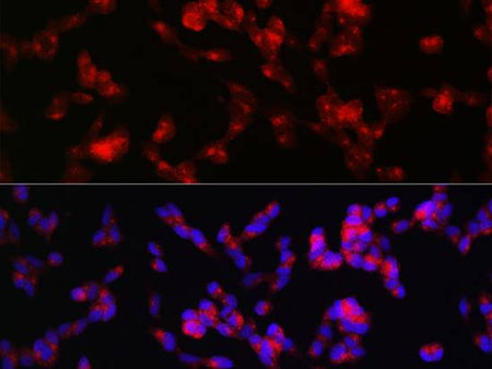 ADAMTS4 Polyclonal Antibody