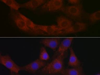 PRG2 Polyclonal Antibody
