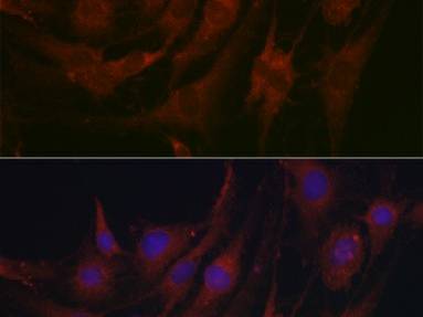 PRG2 Polyclonal Antibody