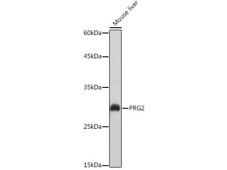 PRG2 Polyclonal Antibody