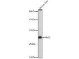 PRG2 Polyclonal Antibody