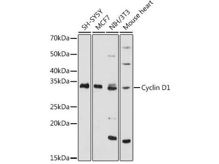 Cyclin D1 Polyclonal Antibody