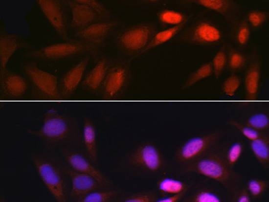 EGR1 Polyclonal Antibody