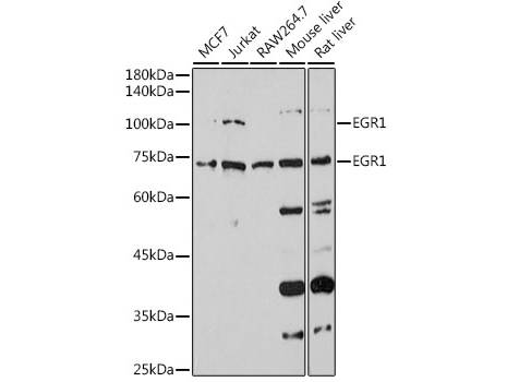 EGR1 Polyclonal Antibody