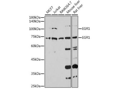 EGR1 Polyclonal Antibody