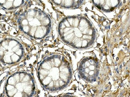 NEUROG3 Polyclonal Antibody