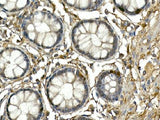 NEUROG3 Polyclonal Antibody