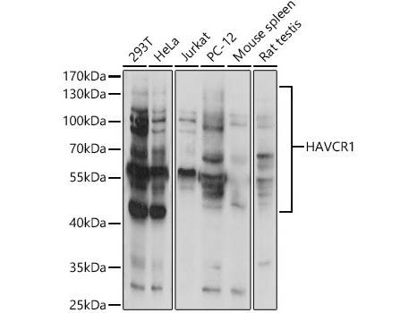 HAVCR1 Polyclonal Antibody