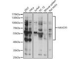 HAVCR1 Polyclonal Antibody