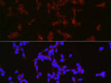 NPY Polyclonal Antibody