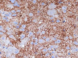 NPY Polyclonal Antibody