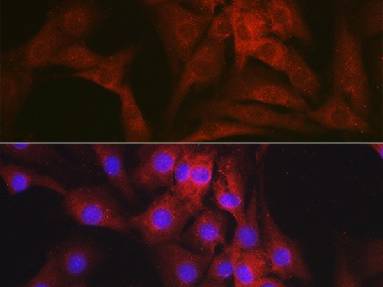 NR3C2 Polyclonal Antibody