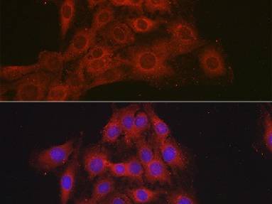 NR3C2 Polyclonal Antibody