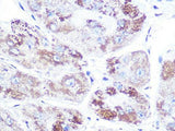 NR3C2 Polyclonal Antibody