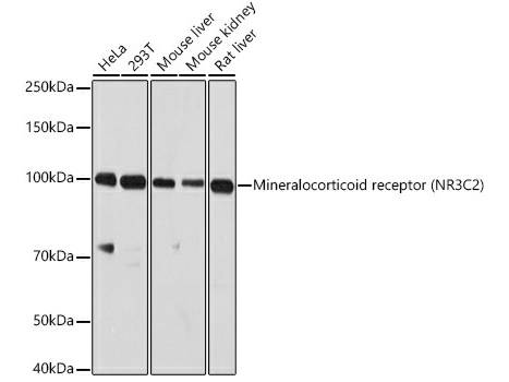 NR3C2 Polyclonal Antibody, Biomarkers, Elabscience Biotechnology, MSE Supplies