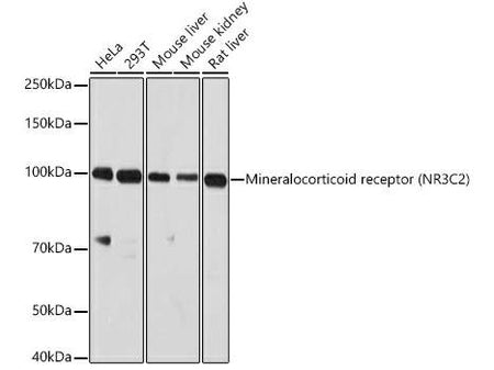 NR3C2 Polyclonal Antibody, Biomarkers, Elabscience Biotechnology, MSE Supplies