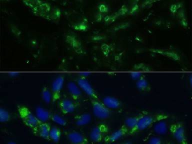 CGRP Polyclonal Antibody