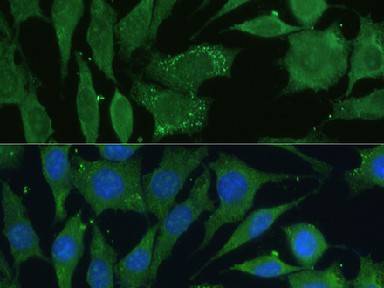 CGRP Polyclonal Antibody