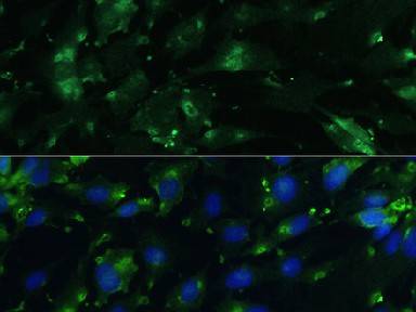 CGRP Polyclonal Antibody