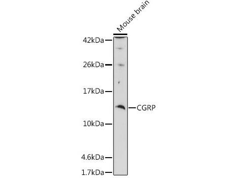 CGRP Polyclonal Antibody