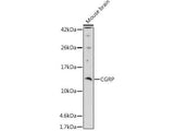 CGRP Polyclonal Antibody
