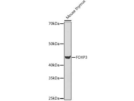 FOXP3 Polyclonal Antibody